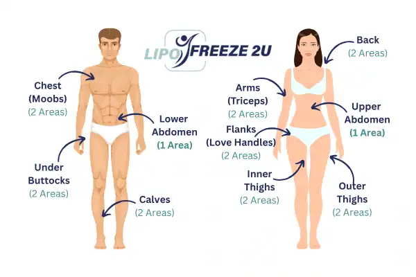 Areas you can have fat freezing treatment Wrexham